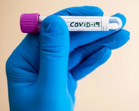 Coronavirus: number of tests stagnates in Switzerland